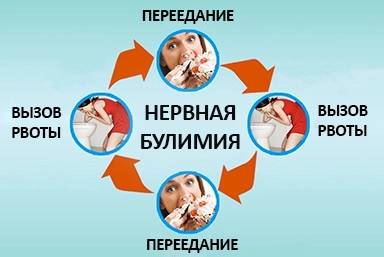 Лечение булимии в Ишеевке